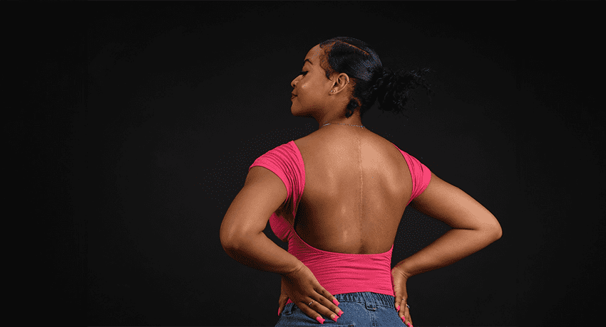 scoliosis management scoliosis